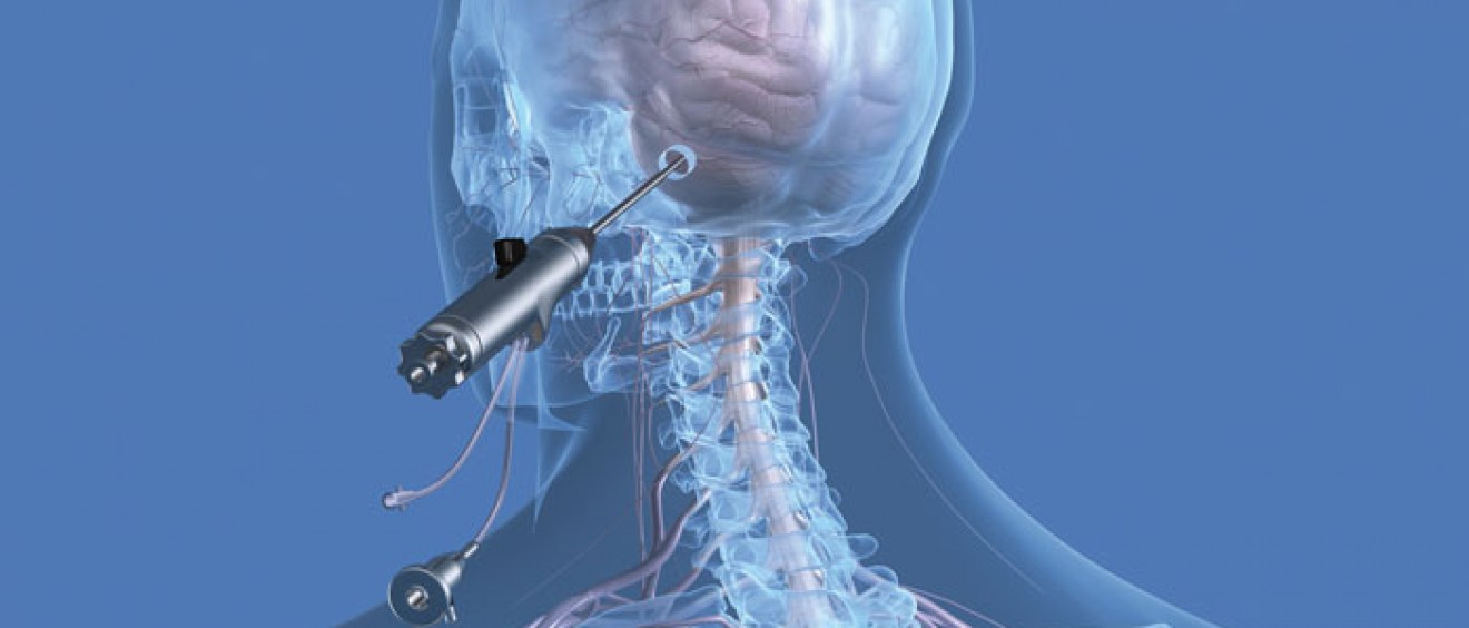 Endoscopy