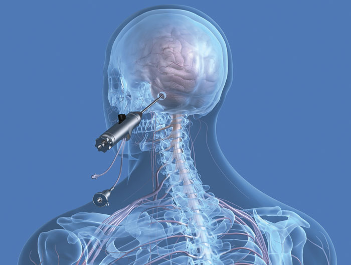 Endoscopy
