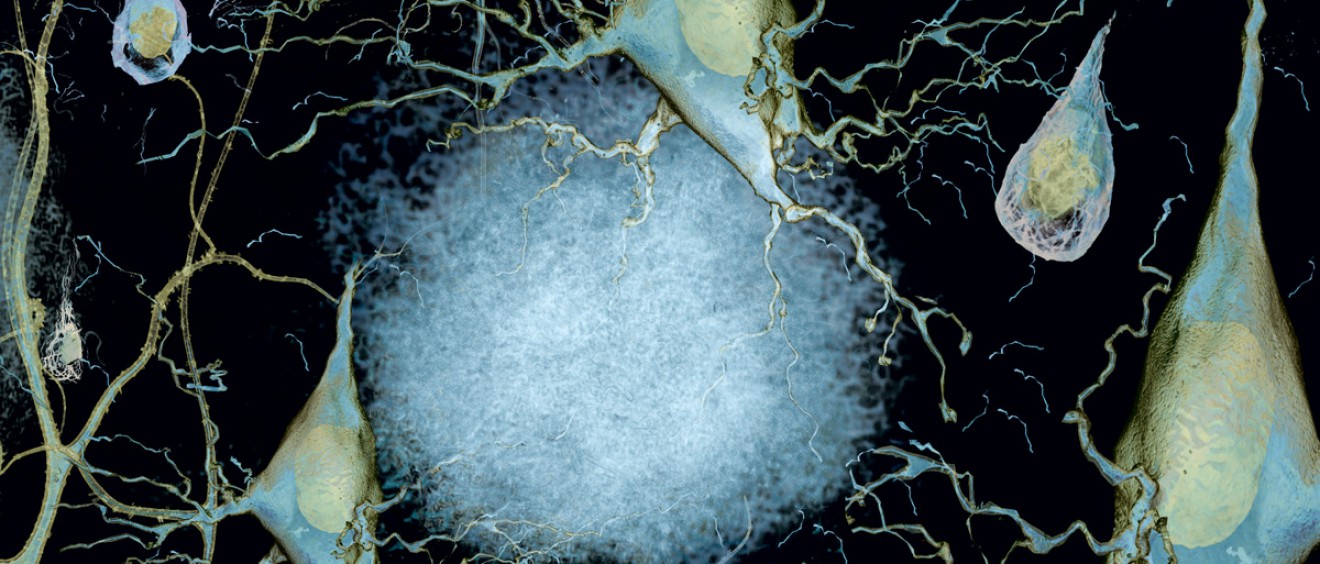 Ann Barshop Institute of Longevity and Aging Studies, Neurons, Alzheimer's Disease