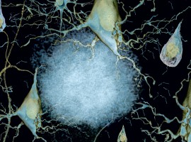 Ann Barshop Institute of Longevity and Aging Studies, Neurons, Alzheimer's Disease