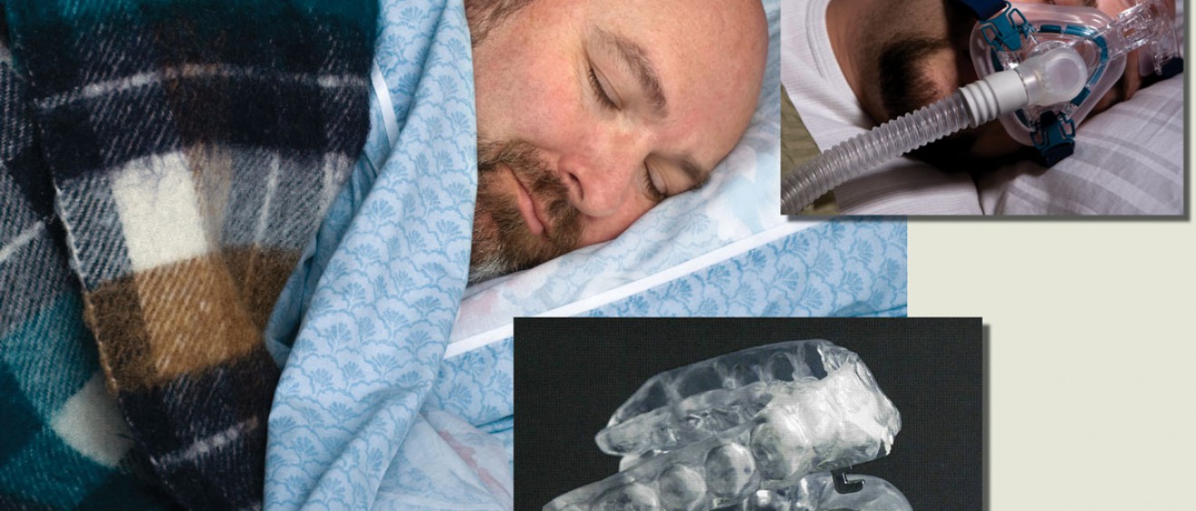 sleep apnea