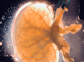 Rodent Kidney Extracellular Scaffold