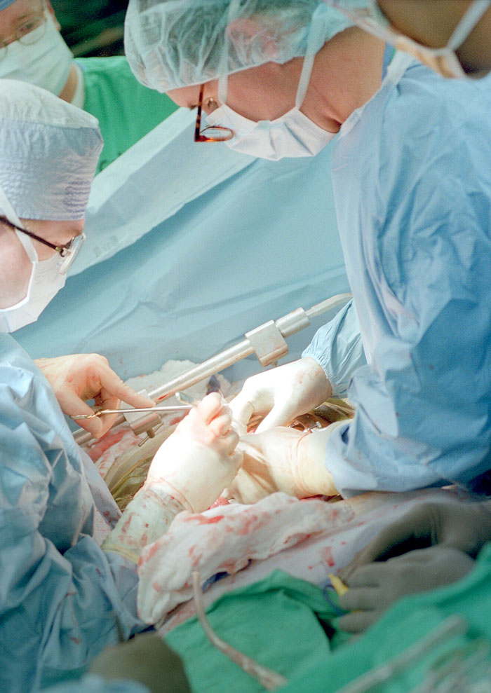 Ronald Stewert M.D.