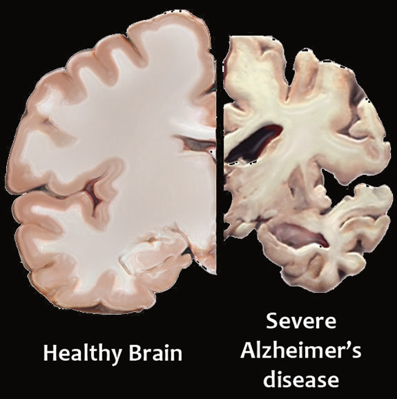 Images courtesy of the National Institutes on Aging of the U.S. National Institutes of Health