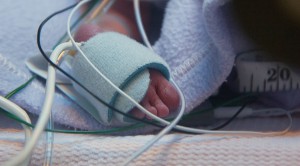 neonatal