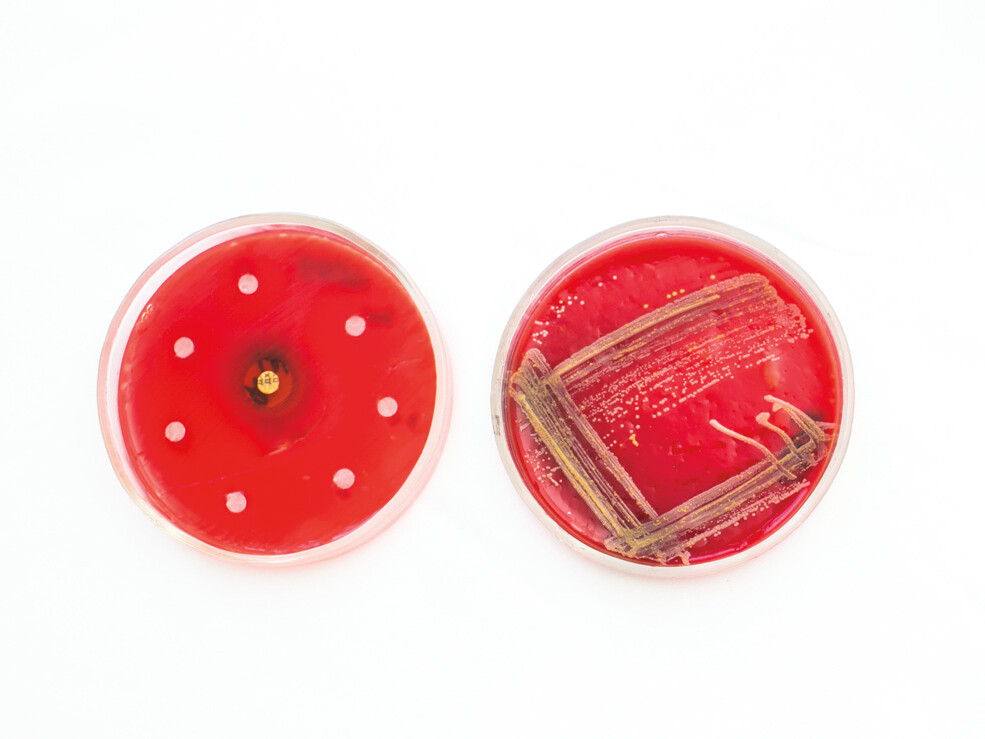 petri dishes