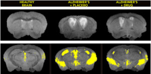 brain scans