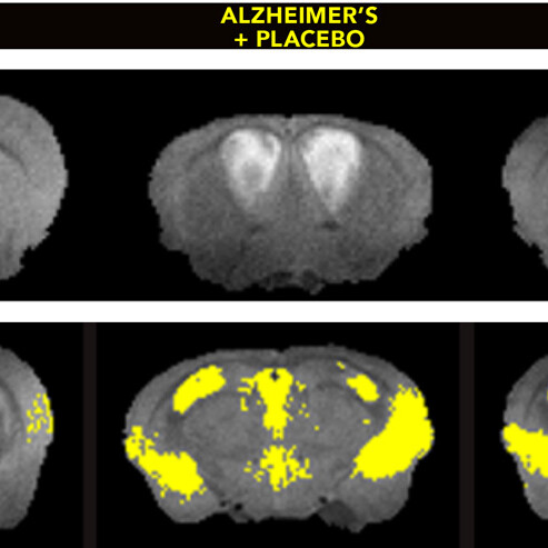 brain scans