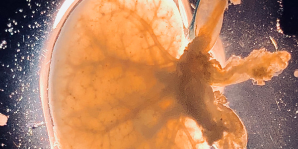 Rodent Kidney Extracellular Scaffold