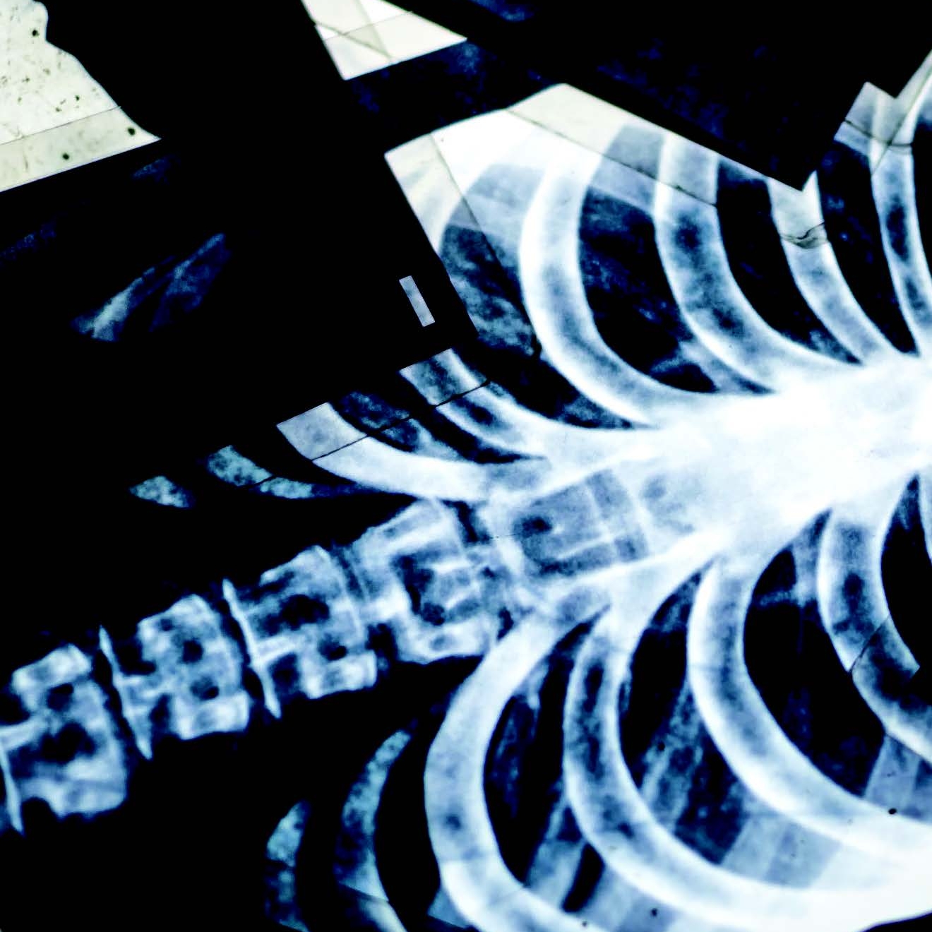 photo of x-ray images
