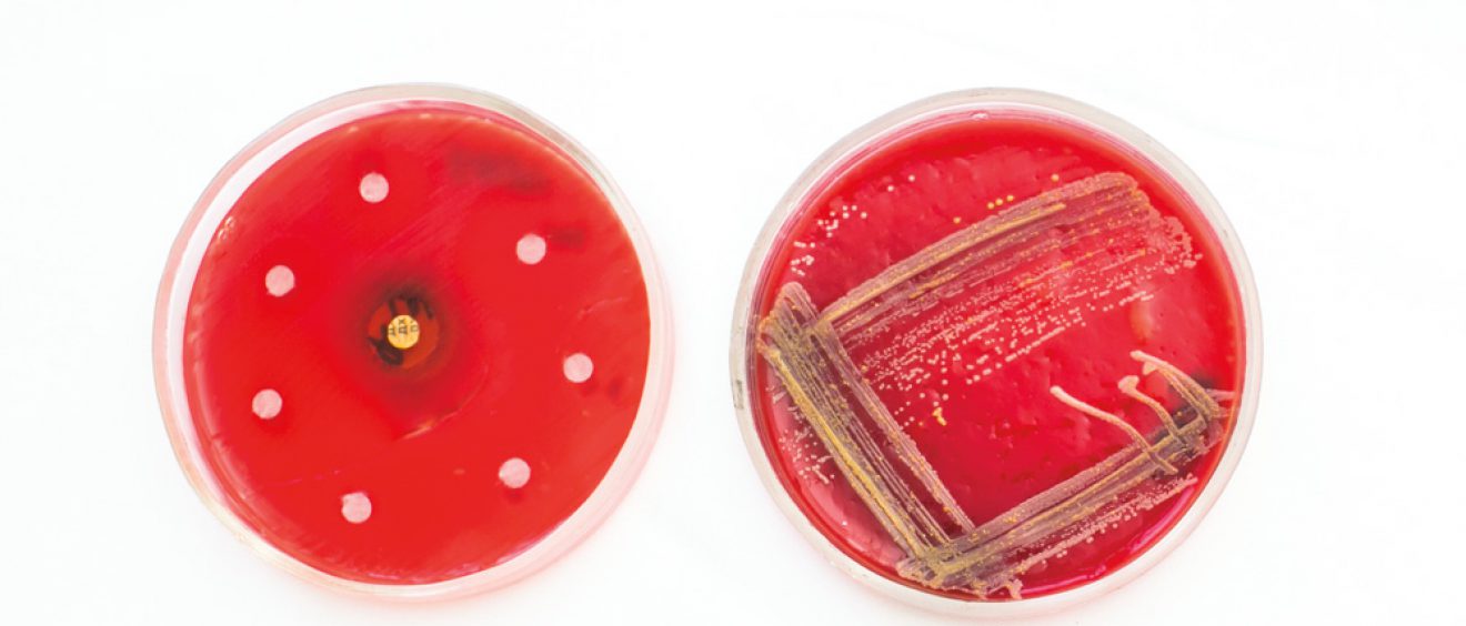 petri dishes