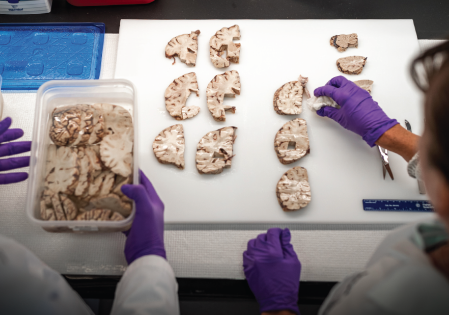 The hands of two researchers move slices of brain on a table.